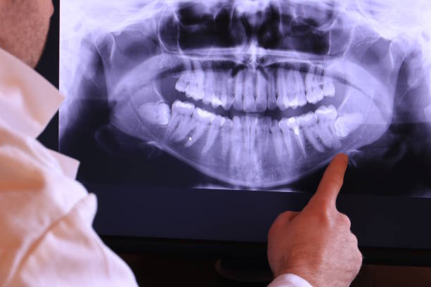 Best Emergency Dental Services for Seniors in Jackson, KY